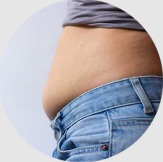 Persona con sensación de hinchazón abdominal